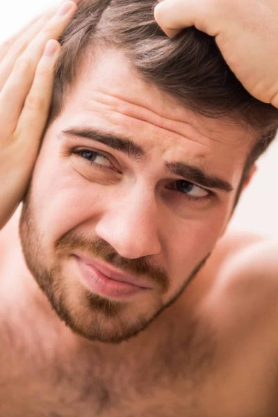 Handsome man is checking hairline while looking at the mirror.